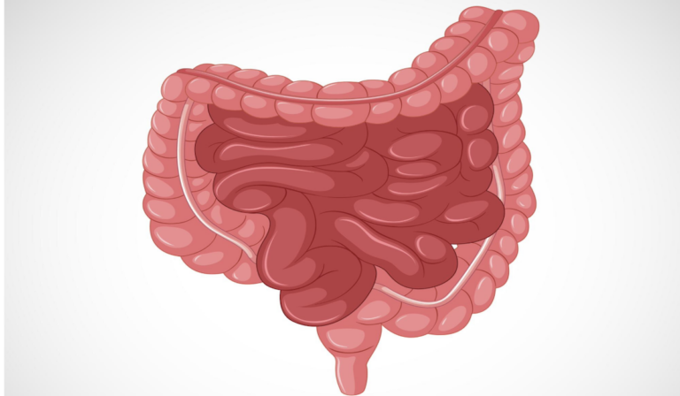 Kanker Usus Besar: Usia Lanjut dan Kasus Masashi Jumbo Ozaki