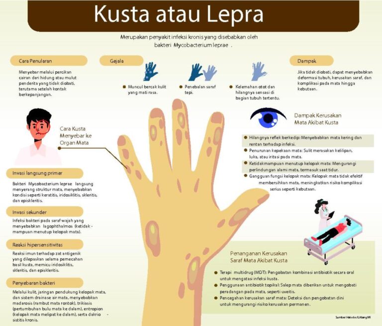 Kusta Sembuh, Namun Penderita Masih Hadapi Stigma Negatif